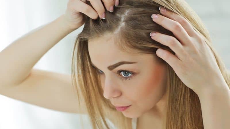 dry scalps vs dandruff