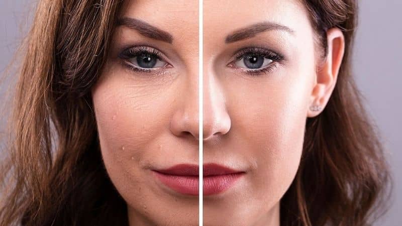 how long to lose face fats