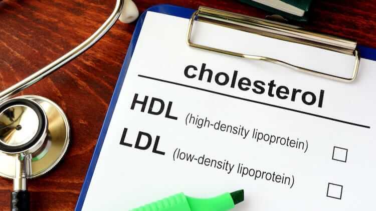 Testosterone And Cholesterol